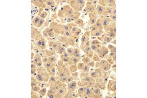 Immunohistochemical analysis of paraffin-embedded H. (UBE2D1 anticorps  (C-Term))
