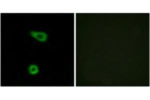 Immunofluorescence (IF) image for anti-Tumor Necrosis Factor, alpha-Induced Protein 2 (TNFAIP2) (AA 131-180) antibody (ABIN2889546) (TNFAIP2 anticorps  (AA 131-180))