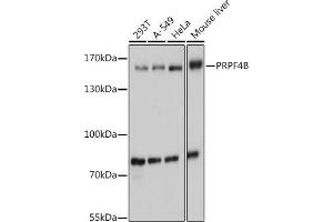 Western blot analysis of extracts of various cell lines, using PRPF4B antibody (ABIN7270232) at 1:1000 dilution. (PRPF4B anticorps  (AA 550-760))