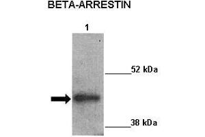 Sample Type :  Lane 1: 20ug mouse left ventricle heart lysate  Primary Antibody Dilution :   1:1000  Secondary Antibody:  Anti-rabbit-HRP  Secondary Antibody Dilution:   1:5000  Color/Signal Descriptions:  ARRB2  Gene Name:  Kathleen Gabrielson  Submitted by: