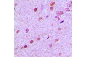 Immunohistochemical analysis of NEUROD2 staining in human brain formalin fixed paraffin embedded tissue section. (NEUROD2 anticorps  (Center))