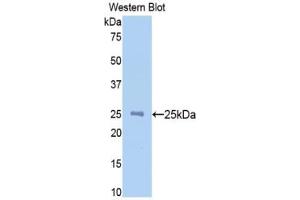 Western blot analysis of the recombinant protein. (NAGA anticorps  (AA 218-415))