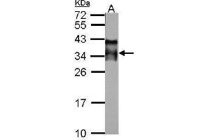 WB Image Sample (50 ug of whole cell lysate) A: mouse testis 12% SDS PAGE antibody diluted at 1:10000 (ACRV1 anticorps)