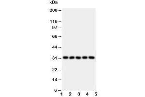 Western blot testing of LOX-1 antibody and Lane 1:  HeLa;  2: SMMC-7721;  3: U87;  4: U937;  5: K562 lysate. (OLR1 anticorps  (N-Term))