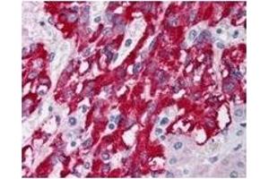 Image no. 1 for anti-Deleted in Liver Cancer 1 (DLC1) (Isoform 1), (Isoform 3), (N-Term) antibody (ABIN452680) (DLC1 anticorps  (Isoform 1, Isoform 3, N-Term))