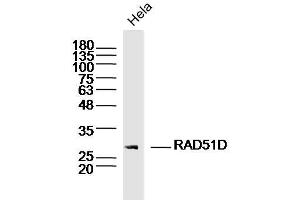 Hela lysates probed with RAD51D Polyclonal Antibody, Unconjugated  at 1:300 dilution and 4˚C overnight incubation. (RAD51D anticorps  (AA 1-100))
