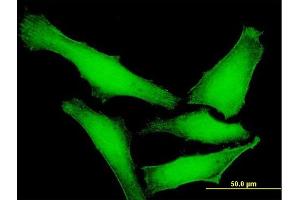 Immunofluorescence of purified MaxPab antibody to DUSP14 on HeLa cell.