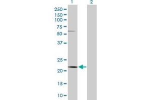 Western Blot analysis of CSN3 expression in transfected 293T cell line by CSN3 MaxPab polyclonal antibody. (CSN3 anticorps  (AA 1-182))