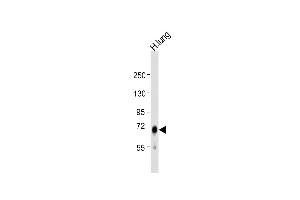 Anti-IDUA Antibody (Center) at 1:1000 dilution + human lung lysate Lysates/proteins at 20 μg per lane.