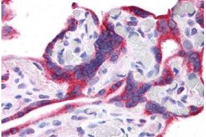 Human Placenta: Formalin-Fixed, Paraffin-Embedded (FFPE)