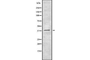 Western blot analysis of CDC123 using COLO205 whole cell lysates (CDC123 anticorps  (Internal Region))