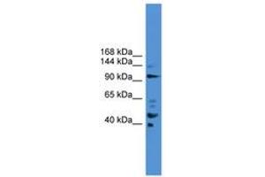 Image no. 1 for anti-Progesterone Immunomodulatory Binding Factor 1 (PIBF1) (AA 601-650) antibody (ABIN6745470) (PIBF1 anticorps  (AA 601-650))
