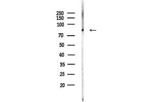 Western blot analysis of lysates from LoVo cells(heat-shock,45 min treatment), using ACVR2A Antibody at 1/1000 dilution.