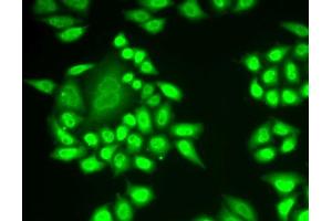 Immunofluorescence analysis of U2OS cells using RNF40 antibody. (RNF40 anticorps  (AA 1-300))