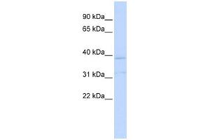 WB Suggested Anti-KCNK15 Antibody Titration:  0. (KCNK15 anticorps  (Middle Region))