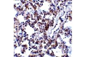 Immunohistochemistry (IHC) image for anti-B-Cell Receptor-Associated Protein 31 (BCAP31) (C-Term) antibody (ABIN1030283) (BCAP31 anticorps  (C-Term))