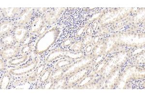 Detection of IL18 in Human Kidney Tissue using Monoclonal Antibody to Interleukin 18 (IL18)