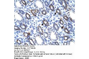 Human kidney (RGS6 anticorps  (C-Term))