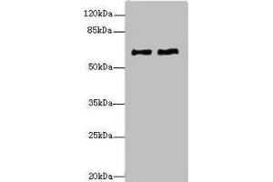 Western blot All lanes: COL9A3antibody at 1. (COL9A3 anticorps  (AA 445-684))