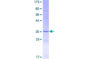 Image no. 1 for Defensin, beta 136 (DEFB136) (AA 1-77) protein (GST tag) (ABIN2801500)