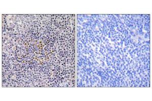 Immunohistochemistry analysis of paraffin-embedded human tonsil tissue using XRCC3 antibody.
