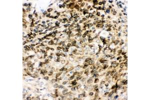 IHC analysis of MAD1 using anti-MAD1 antibody (ABIN3043387). (MAD1L1 anticorps  (AA 362-632))