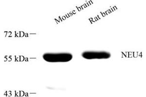 Western blot analysis of NEU4 (ABIN7075594) at dilution of 1: 1000 (Sialidase 4 anticorps)