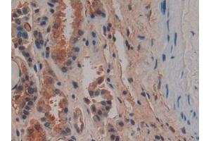 Detection of OPN in Human Kidney Tissue using Polyclonal Antibody to Osteopontin (OPN)