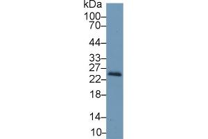 Detection of RBP4 in Mouse Kidney lysate using Polyclonal Antibody to Retinol Binding Protein 4 (RBP4)