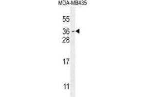 Western blot analysis in MDA-MB435 cell line lysates (35ug/lane) using MYCT1 Antibody (C-term).