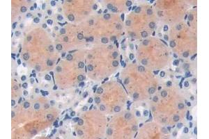 Detection of PARP in Mouse Kidney Tissue using Polyclonal Antibody to Poly ADP Ribose Polymerase (PARP)