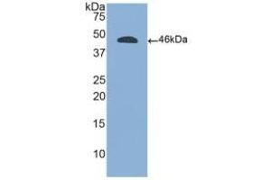 Detection of Recombinant CD45, Human using Polyclonal Antibody to Protein Tyrosine Phosphatase Receptor Type C (CD45) (CD45 anticorps  (AA 193-575))