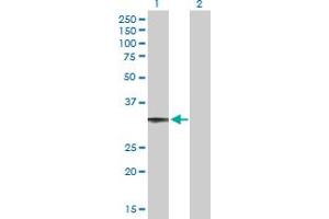 Western Blot analysis of CCDC108 expression in transfected 293T cell line by CCDC108 MaxPab polyclonal antibody. (CCDC108 anticorps  (AA 1-271))