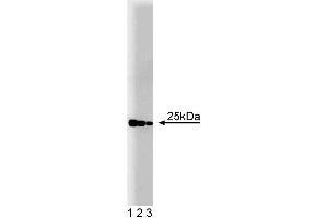 Western blot analysis of Rab4 on a rat cerebrum lysate. (Rab4 anticorps  (AA 97-213))