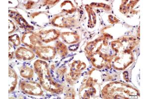 Formalin-fixed and paraffin embedded human kidney labeled with Anti-PRSS8 Polyclonal Antibody, Unconjugated (ABIN761891) at 1:200 followed by conjugation to the secondary antibody and DAB staining