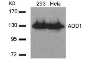 Image no. 3 for anti-Adducin 1 (Alpha) (ADD1) (Ser726) antibody (ABIN197407) (alpha Adducin anticorps  (Ser726))