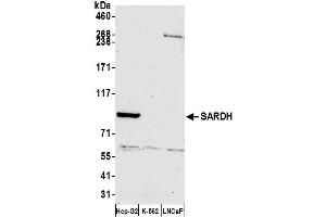 anti-Sarcosine Dehydrogenase (SARDH) (AA 225-275) antibody
