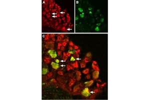 Expression of TRPV1 in rat DRG - Immunohistochemical staining of rat dorsal root ganglion (DRG) using Anti-TRPV1 (VR1) Antibody (ABIN7043841, ABIN7043988 and ABIN7043989).