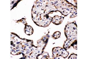 Anti-Aromatase antibody, IHC(P) IHC(P): Human Placenta Tissue (Aromatase anticorps  (C-Term))