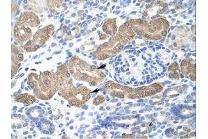 Image no. 1 for anti-Lethal(3) Malignant Brain Tumor-Like Protein 2 (L3MBTL2) (AA 576-625) antibody (ABIN202876)
