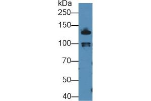 Detection of 0 in Mouse Liver lysate using Polyclonal Antibody to E-cadherin