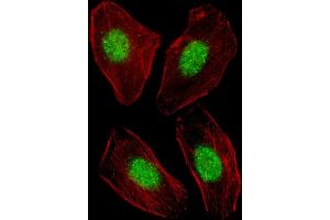 Fluorescent image of  cell stained with NR1H3 Antibody (Center) (ABIN653910 and ABIN2843147). (NR1H3 anticorps  (AA 226-253))