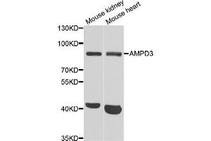 Western blot analysis of extracts of mouse kidney and mouse heart cell lines, using AMPD3 antibody.
