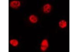 ABIN6273995 staining LOVO by IF/ICC.