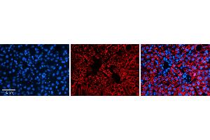 Rabbit Anti-ALDH6A1 Antibody   Formalin Fixed Paraffin Embedded Tissue: Human Liver Tissue Observed Staining: Cytoplasm in hepatocytes Primary Antibody Concentration: N/A Other Working Concentrations: 1:600 Secondary Antibody: Donkey anti-Rabbit-Cy3 Secondary Antibody Concentration: 1:200 Magnification: 20X Exposure Time: 0.