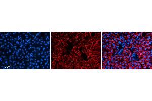 Rabbit Anti-ALDH6A1 Antibody   Formalin Fixed Paraffin Embedded Tissue: Human Liver Tissue Observed Staining: Cytoplasm in hepatocytes Primary Antibody Concentration: N/A Other Working Concentrations: 1:600 Secondary Antibody: Donkey anti-Rabbit-Cy3 Secondary Antibody Concentration: 1:200 Magnification: 20X Exposure Time: 0. (ALDH6A1 anticorps  (Middle Region))
