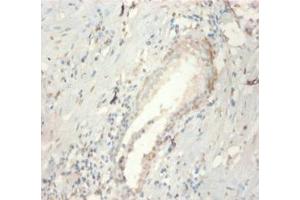 Immunohistochemistry of paraffin-embedded human prostate tissue using ABIN7152807 at dilution of 1:100 (FGF21 anticorps  (AA 29-209))