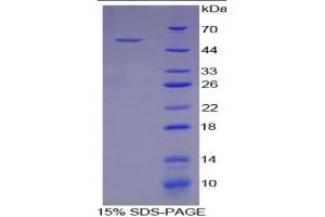 SDS-PAGE of Protein Standard from the Kit  (Highly purified E.