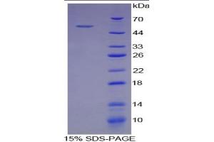 SDS-PAGE of Protein Standard from the Kit  (Highly purified E. (Selectin E/CD62e Kit ELISA)