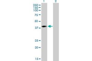 Western Blot analysis of ARPM1 expression in transfected 293T cell line by ARPM1 MaxPab polyclonal antibody. (ARPM1 anticorps  (AA 1-372))